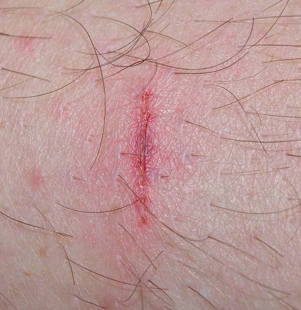 work injury lawyer Albany