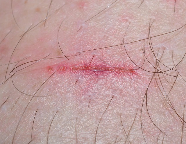 work injury lawyer Albany