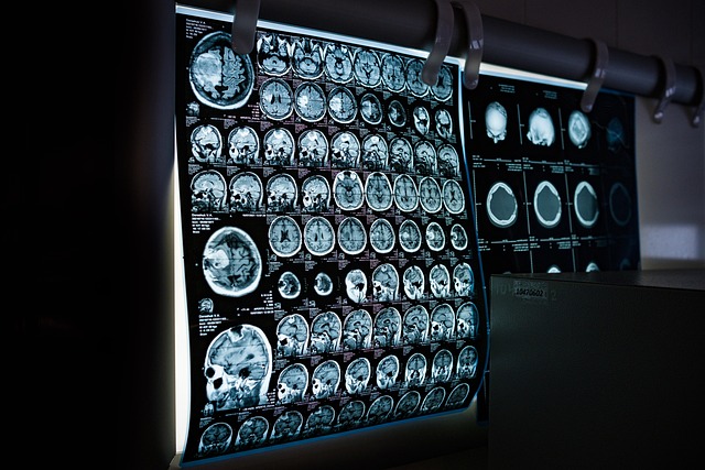 Albany Medical Malpractice Attorney