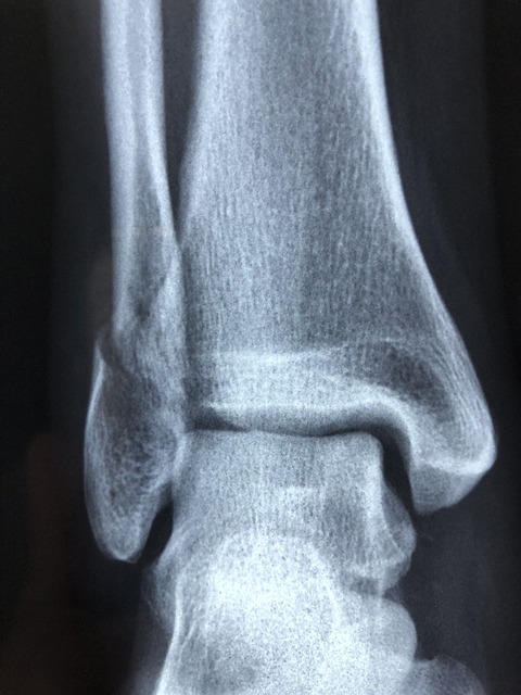 albany-personal-injury-claim-640x480-96036669.jpeg