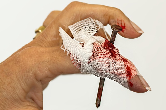 Car Accident Injury Lawyer Albany