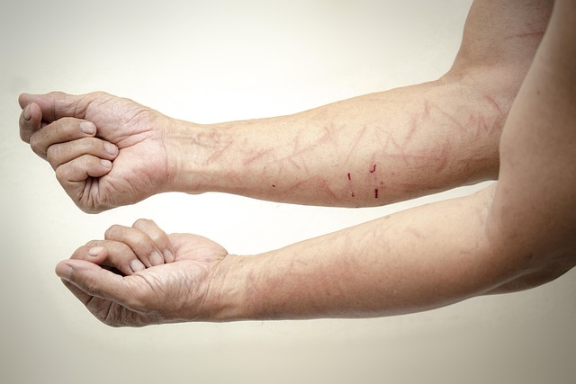 healthcare worker injury attorney Albany