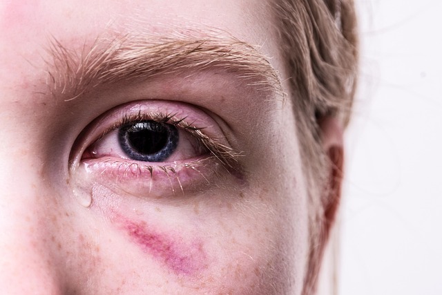 Injury Lawyer Albany