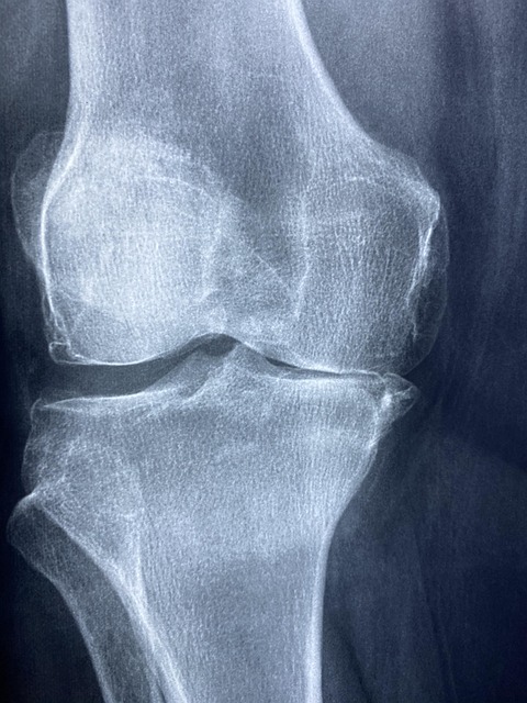 Albany Personal Injury Claim