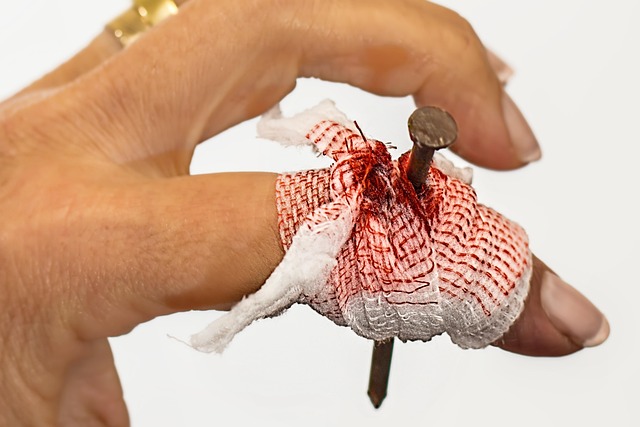 Car Accident Injury Lawyer Albany